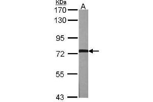 GRK2 抗体  (C-Term)