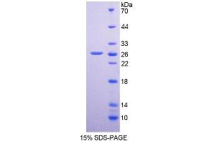 SDS-PAGE analysis of Human DPP6 Protein. (DPP6 蛋白)