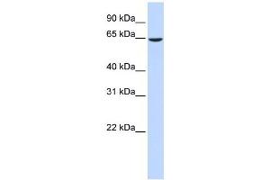 EHD4 antibody used at 1 ug/ml to detect target protein. (EHD4 抗体  (Middle Region))