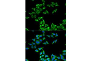Immunofluorescence (IF) image for anti-Charged Multivesicular Body Protein 2B (CHMP2B) antibody (ABIN1876587) (CHMP2B 抗体)