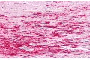 Image no. 1 for anti-Bradykinin Receptor B1 (BDKRB1) (Cytoplasmic Domain) antibody (ABIN1048348) (BDKRB1 抗体  (Cytoplasmic Domain))