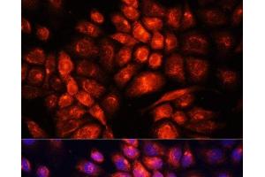 Immunofluorescence analysis of HeLa cells using UCP3 Polyclonal Antibody at dilution of 1:100. (UCP3 抗体)