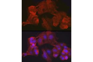 Immunofluorescence analysis of HepG2 cells using Villin1 Rabbit mAb (ABIN7271323) at dilution of 1:100 (40x lens). (Villin 1 抗体)