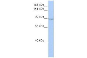 Hexokinase 2 antibody used at 1 ug/ml to detect target protein. (Hexokinase 2 抗体  (N-Term))