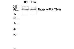 Western Blot (WB) analysis of 3T3 HeLa lysis using Phospho-FAK (Y861) antibody. (FAK 抗体  (pTyr861))