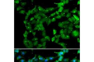 Immunofluorescence analysis of U2OS cells using PRKAB2 Polyclonal Antibody (PRKAB2 抗体)