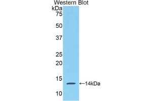 Western blot analysis of the recombinant protein. (SAA 抗体  (AA 20-122))