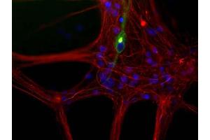 Mixed neuron/glia cultures from newborn rat brain stained with ABIN1580456 antibody to peripherin (green) and rabbit polyclonal antibody to NF-L RPCA-NF-L (red channel).