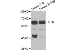 Western Blotting (WB) image for anti-Biotinidase (BTD) antibody (ABIN1980300) (BTD 抗体)