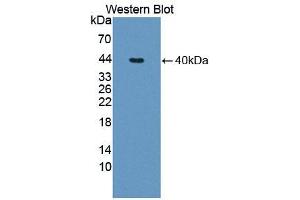 Western blot analysis of the recombinant protein. (TNNT1 抗体  (AA 1-261))
