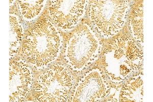 ABIN6264964 and ABIN6273072 at 1/100 staining Rat testis tissue by IHC-P.