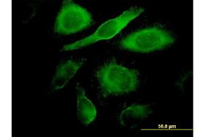 Immunofluorescence of monoclonal antibody to CDK4 on HeLa cell. (CDK4 抗体  (AA 211-303))