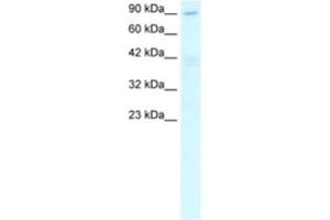 Western Blotting (WB) image for anti-Chromosome 20 Open Reading Frame 194 (C20orf194) antibody (ABIN2460292) (C20orf194 抗体)