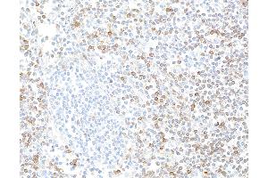 Immunohistochemistry (IHC) image for anti-Interleukin 7 Receptor (IL7R) (AA 21-236) antibody (ABIN7453897) (Recombinant IL7R 抗体  (AA 21-236))