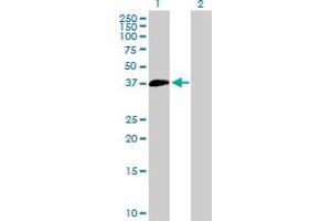 Western Blot analysis of SUV39H2 expression in transfected 293T cell line by SUV39H2 MaxPab polyclonal antibody. (SUV39H2 抗体  (AA 1-350))