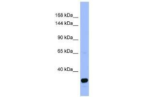 FANCA antibody used at 1 ug/ml to detect target protein. (FANCA 抗体  (N-Term))