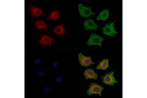 ABIN6256799 and ABIN6267420 staining HepG2 cells(4h of LPS treatment) by IF/ICC. (Phospholipase C gamma 1 抗体  (pTyr771))