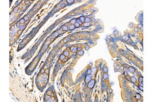 ABIN6258512 and ABIN6274729 at 1/100 staining Rat stomach tissue by IHC-P. (MRPL13 抗体  (C-Term))