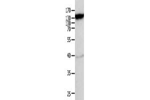 Gel: 10 % SDS-PAGE, Lysate: 40 μg, Lane: Mouse heart tissue, Primary antibody: ABIN7189591(ABCC5 Antibody) at dilution 1/950, Secondary antibody: Goat anti rabbit IgG at 1/8000 dilution, Exposure time: 10 minutes