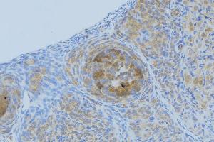 ABIN6268949 at 1/100 staining Human uterus tissue by IHC-P. (CXCL1 抗体  (Internal Region))