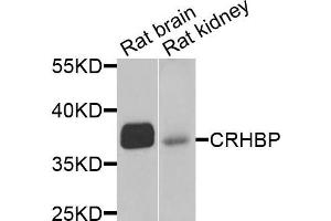 Western blot analysis of extracts of rat brain and rat kidney cells, using CRHBP antibody. (CRHBP 抗体)
