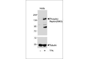 Western blot analysis of lysates from Hela cell line, untreated or treated with T, 200nM , using Phospho-Raptor Antibody (upper) or tubulin (lower). (RAPTOR 抗体  (pSer863))