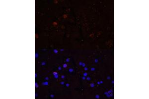 Immunofluorescence analysis of THP-1 cells using CD86 Polyclonal Antibody (ABIN7266226) at dilution of 1:100 (40x lens). (CD86 抗体)