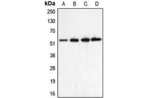 Western blot analysis of CHRNA5 expression in HeLa (A), Jurkat (B), mouse brain (C), rat brain (D) whole cell lysates. (CHRNA5 抗体  (Center))