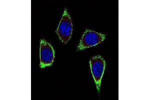 Confocal immunofluorescent analysis of RET Antibody (Ascites) ABIN659065 with MDA-M cell followed by Alexa Fluor® 488-conjugated goat anti-mouse lgG (green).