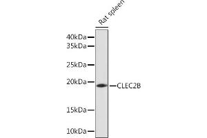 Western blot analysis of extracts of Rat spleen, using CLEC2B Rabbit pAb (ABIN7265981) at 1:1000 dilution. (CLEC2B 抗体)