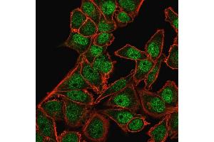 Immunofluorescence Analysis of PFA-fixed HeLa cells labeling BMI1 with BMI1 Mouse Monoclonal Antibody (BMI1/2823) followed by Goat anti-Mouse IgG-CF488 (Green).
