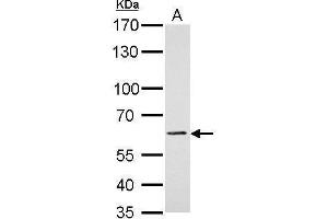 WB Image PAK1 antibody detects PAK1 protein by Western blot analysis. (PAK1 抗体  (Center))