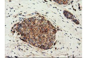 Immunohistochemistry (IHC) image for anti-ClpP Caseinolytic Peptidase, ATP-Dependent, Proteolytic Subunit Homolog (E. Coli) (CLPP) antibody (ABIN1497535)