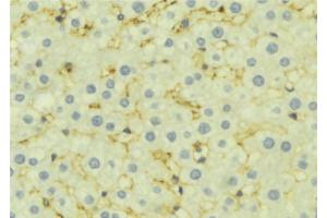 ABIN6277169 at 1/100 staining Mouse liver tissue by IHC-P. (Presenilin 1 抗体  (Internal Region))