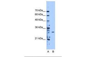 Image no. 1 for anti-Methyltransferase Like 1 (METTL1) (AA 151-200) antibody (ABIN341635) (METTL1 抗体  (AA 151-200))