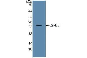Western blot analysis of recombinant Human Tie2. (TEK 抗体  (AA 286-465))