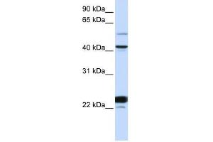 Western Blot showing EVX1 antibody used at a concentration of 1-2 ug/ml to detect its target protein. (EVX1 抗体  (N-Term))