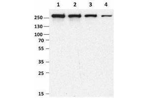 Western Blotting (WB) image for anti-Mechanistic Target of Rapamycin (serine/threonine Kinase) (mTOR) antibody (ABIN2665281) (MTOR 抗体)