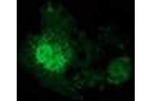 Anti-EIF4E2 mouse monoclonal antibody (ABIN2454244) immunofluorescent staining of COS7 cells transiently transfected by pCMV6-ENTRY EIF4E2 (RC201391). (EIF4E2 抗体)