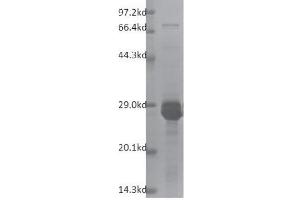 Recombinant TRIM28 (624-811) protein gel.