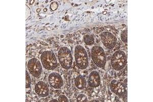 Immunohistochemical staining of human small intestine with COX8C polyclonal antibody  shows strong cytoplasmic and membranous positivity with granular pattern in glandular cells.