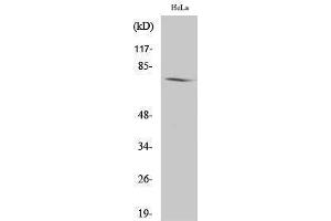 Western Blotting (WB) image for anti-Amphiphysin (AMPH) (Internal Region) antibody (ABIN3173773) (Amphiphysin 抗体  (Internal Region))