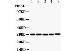 Western blot analysis of sCD40L using anti- sCD40L antibody . (CD40 Ligand 抗体  (N-Term))