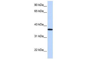 Lipocalin 12 antibody used at 1 ug/ml to detect target protein. (LCN12 抗体  (N-Term))