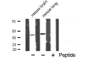 Western blot analysis of POLB expression in various lysates (POLB 抗体  (C-Term))