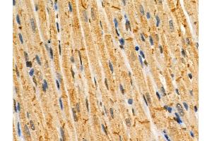 Phospho-DRP1 (Ser548) Antibody at 1/100 staining Rat heart tissue by IHC-P.