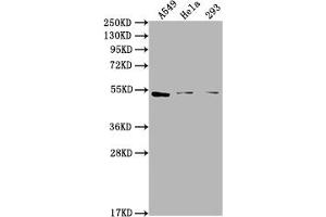 Western Blot Positive WB detected in: A549 whole cell lysate, Hela whole cell lysate, 293 whole cell lysate All lanes: CNR1 antibody at 1:2000 Secondary Goat polyclonal to rabbit IgG at 1/50000 dilution Predicted band size: 53, 46, 50 kDa Observed band size: 53 kDa (CNR1 抗体  (AA 1-116))