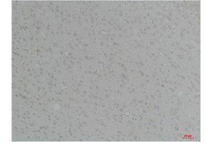 Immunohistochemistry (IHC) analysis of paraffin-embedded Rat Brain Tissue using KCNN4(SK4) Rabbit Polyclonal Antibody diluted at 1:200.