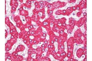 Anti-THEM2 / ACOT13 antibody IHC of human liver. (THEM2 抗体  (AA 100-150))