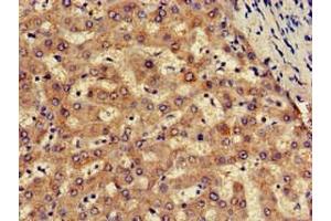 Immunohistochemistry of paraffin-embedded human liver tissue using ABIN7170102 at dilution of 1:100 (SLC13A5 抗体  (AA 156-204))